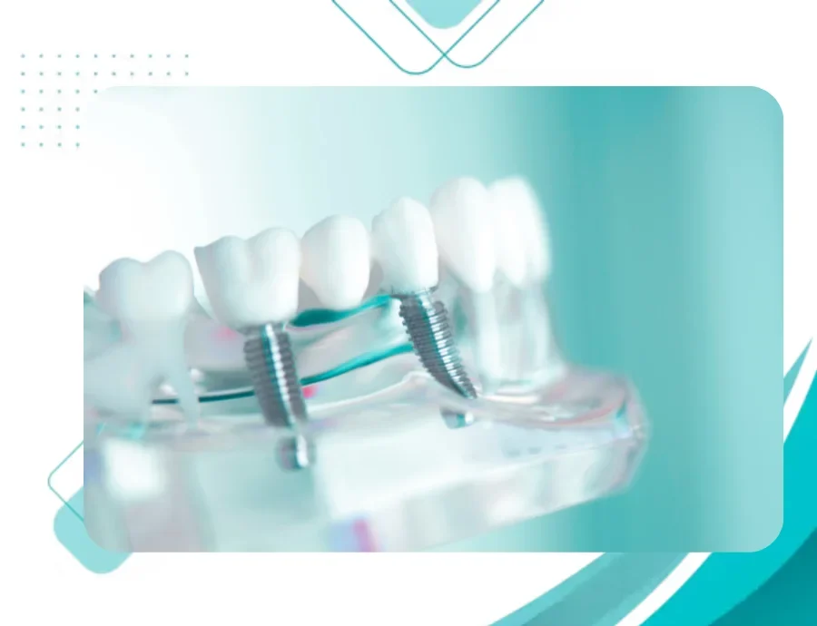 Coventry Dental Implant Treatments Dentist Announces Private Patient Appointments at Light Lane Dental Practice